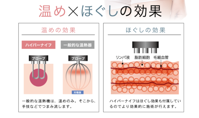 ハイパーナイフほぐし